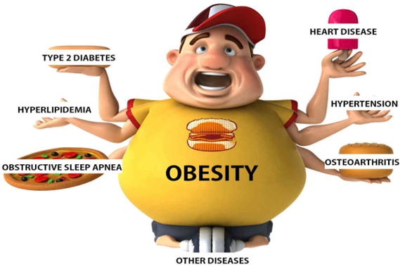 Obesity In Adults: Dietary Therapy